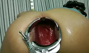 Spekulum wuok gi ng’ ...