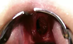 Kuong'o ng'ute nyadi ...