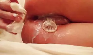 Anal ma opong’ gi sp ...